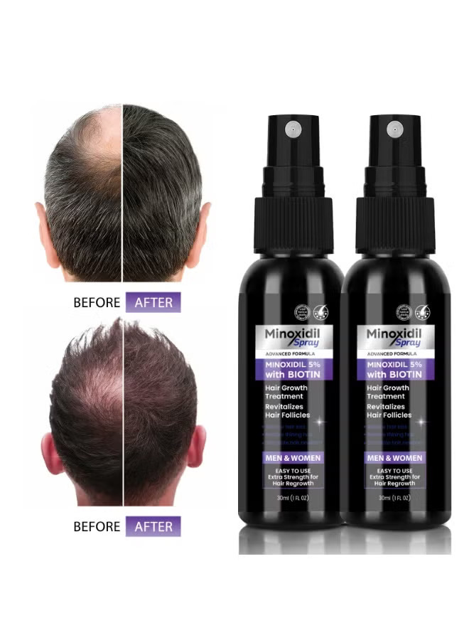 Minoxidil 5% Hair Growth Spray