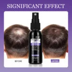 Minoxidil 5% Hair Growth Spray